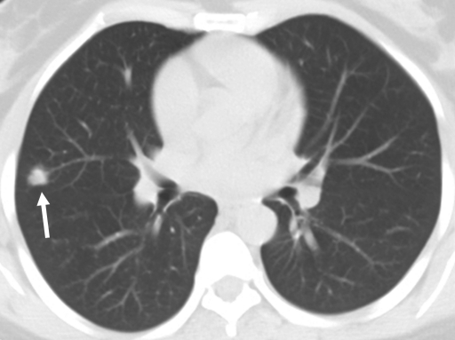 Figure 1c: