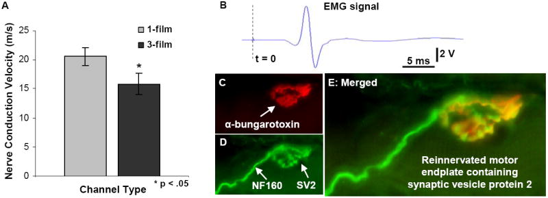 Fig. 12