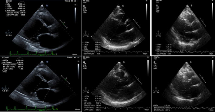 FIGURE 2