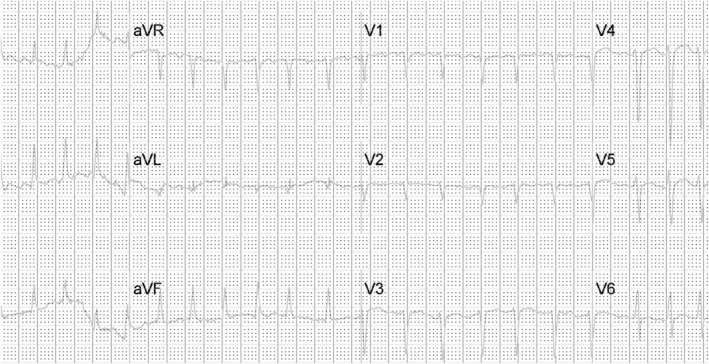 FIGURE 1