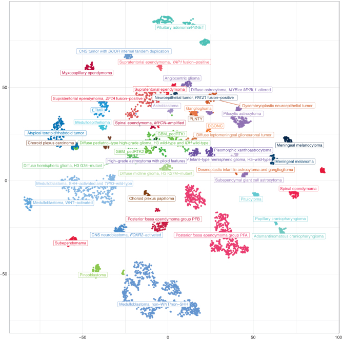 Figure 3. Molecular groups of pediatric CNS tumors (at the level of superfamilies). Unsupervised, nonlinear t-distributed stochastic neighbor embedding (t-SNE) projection of methylation array profiles from 4,427 tumors. Samples were selected from a large database of >90,000 CNS tumor datasets to serve as reference profiles for training a supervised classification model based on strict criteria: all these samples showed a high calibrated classification score (>0.9) when applying the brain tumor classifier available at https://www.molecularneuropathology.org.