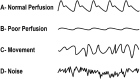Figure 16