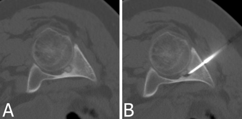 Fig. 4A–B