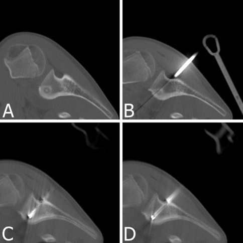 Fig. 2A–D