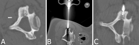 Fig. 3A–C