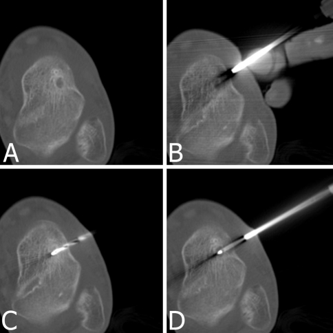 Fig. 1A–D