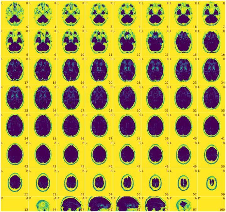 Figure 12 |