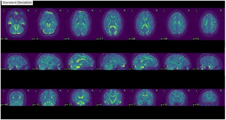 Figure 11 |