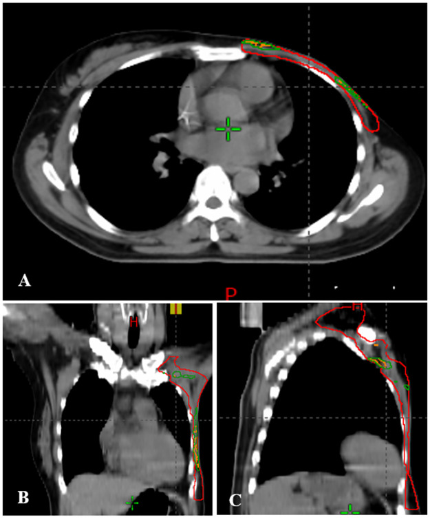 Fig 4