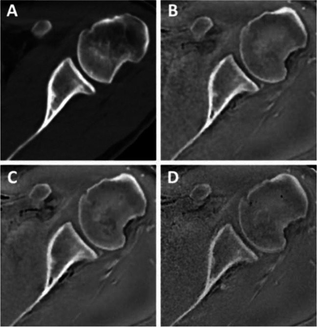 Fig. 6