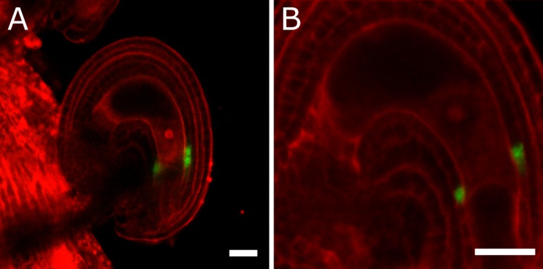 Figure 2—figure supplement 1.