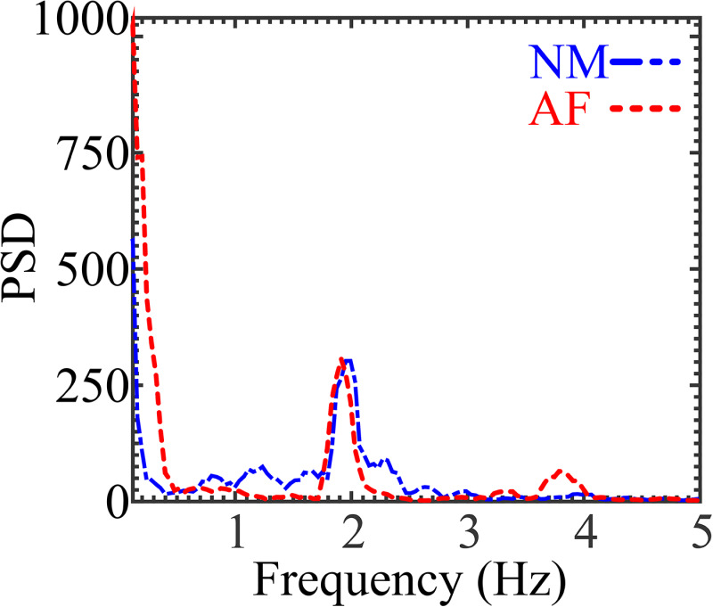 PSD analysis from mice shows the most energetic tissue movements around 2 and 1.9 Hz for the normal and affected mice, respectively