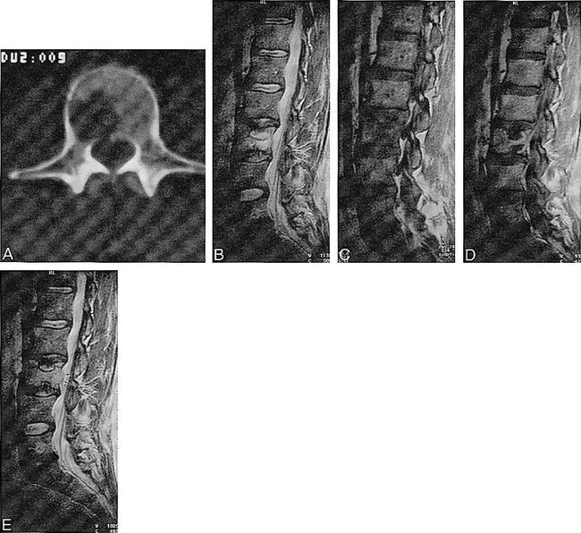 fig 2.