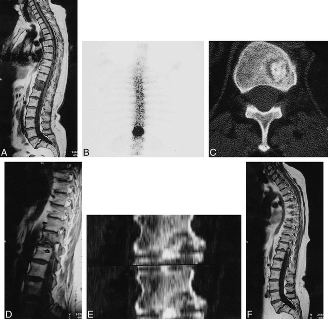 fig 1.