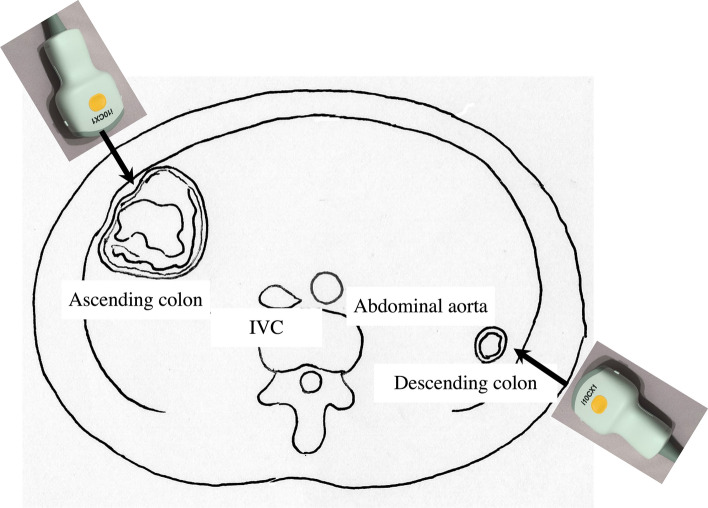 Fig. 17