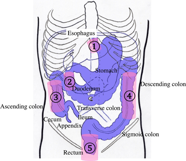 Fig. 1