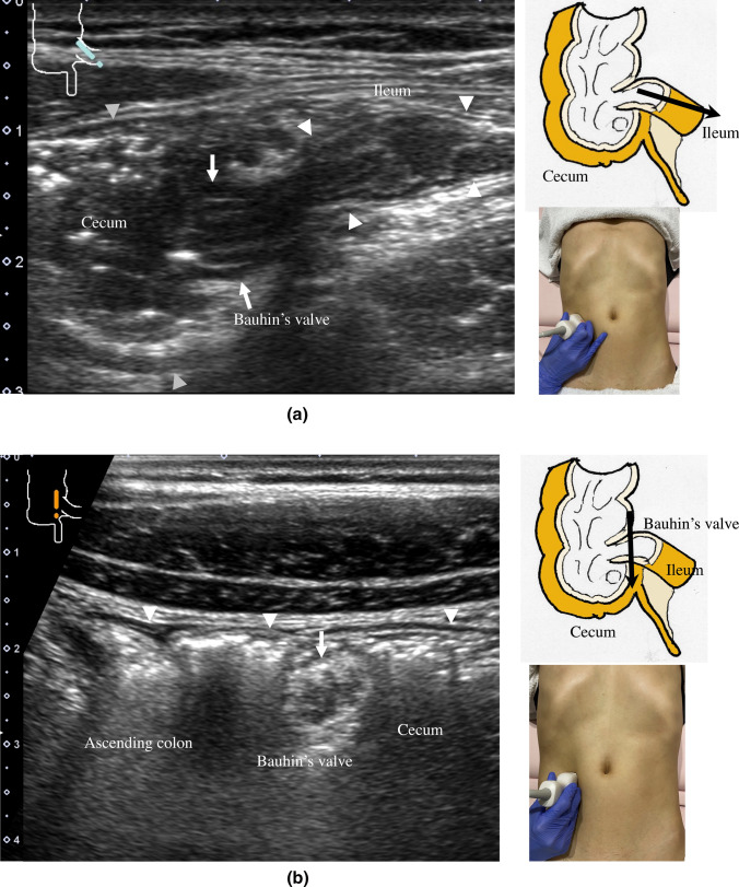 Fig. 15