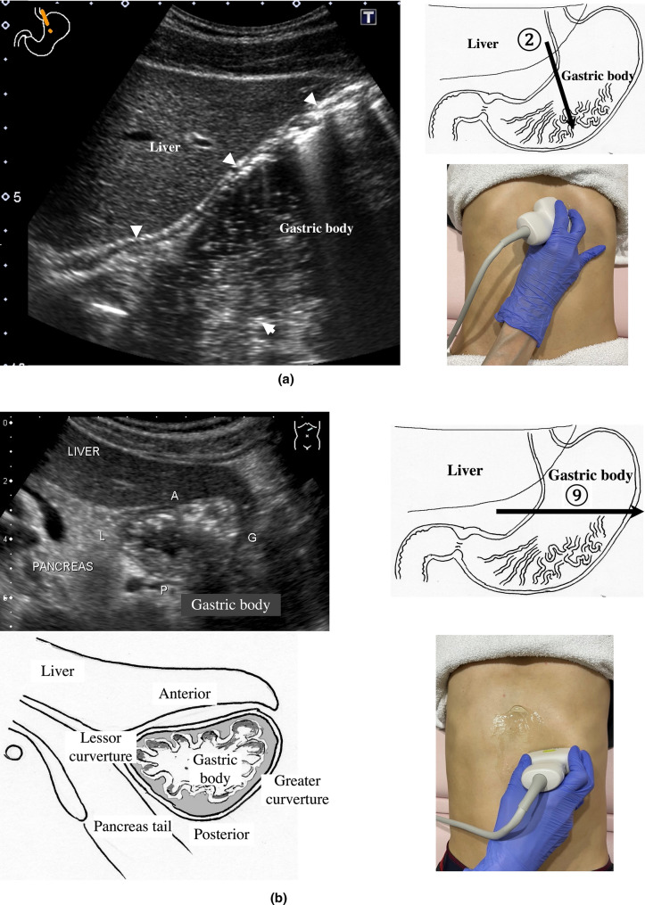 Fig. 6