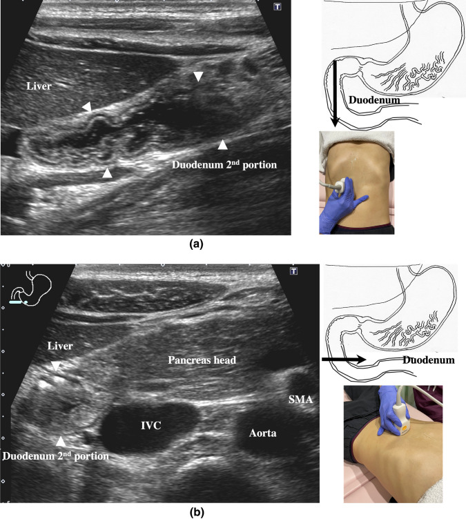 Fig. 10