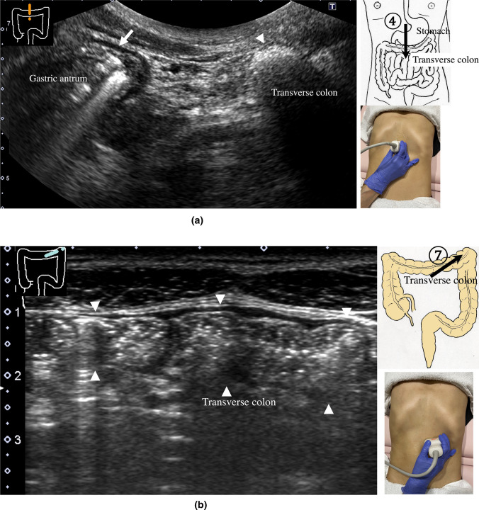 Fig. 20