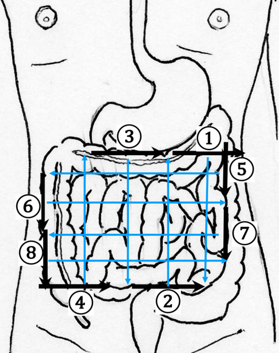 Fig. 12