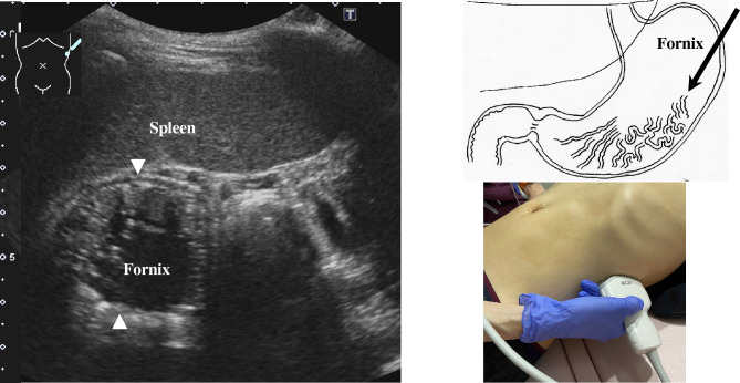 Fig. 5