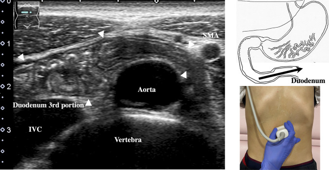 Fig. 11