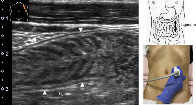 Fig. 13