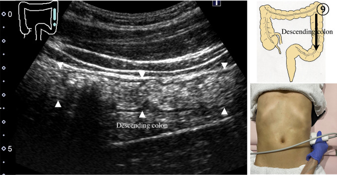 Fig. 21