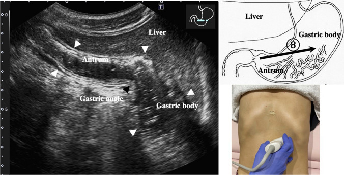 Fig. 7