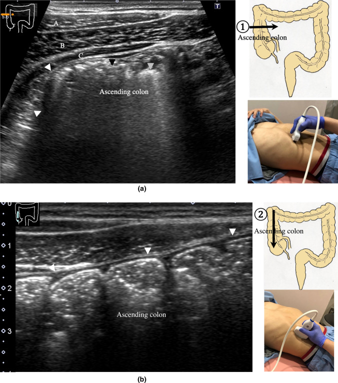 Fig. 18