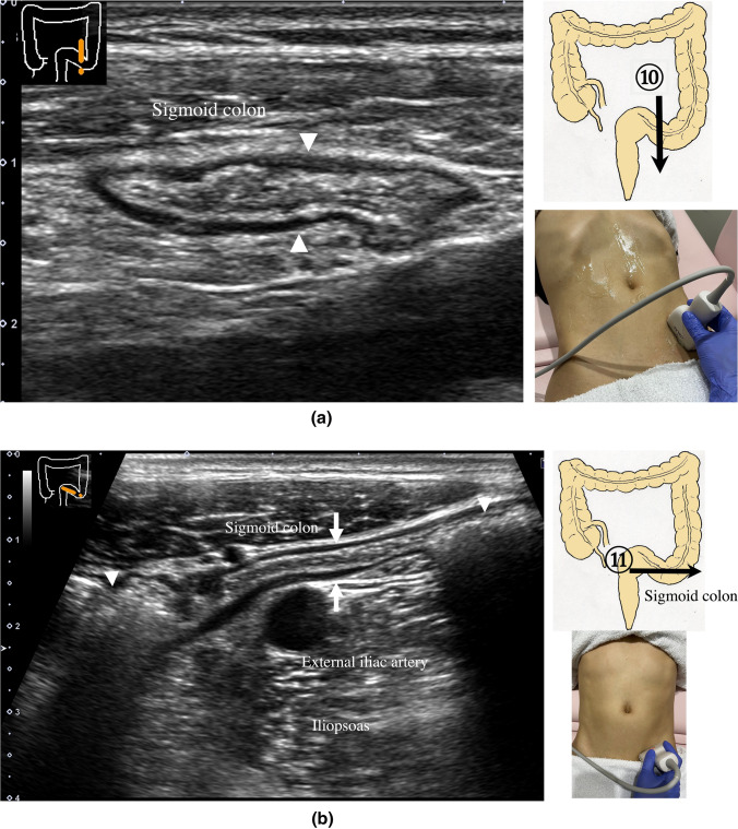 Fig. 22