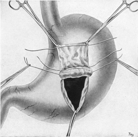 FIG. 5.