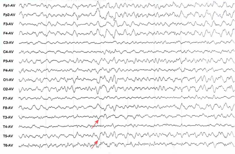 Figure 3.