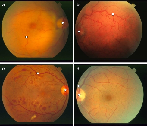 Fig 6.