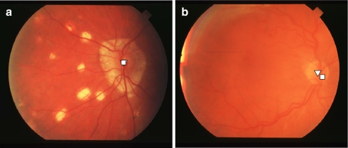 Fig 7.