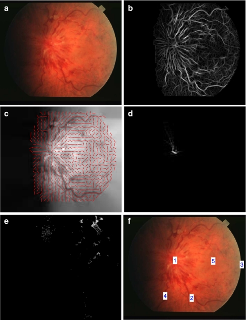 Fig 1.