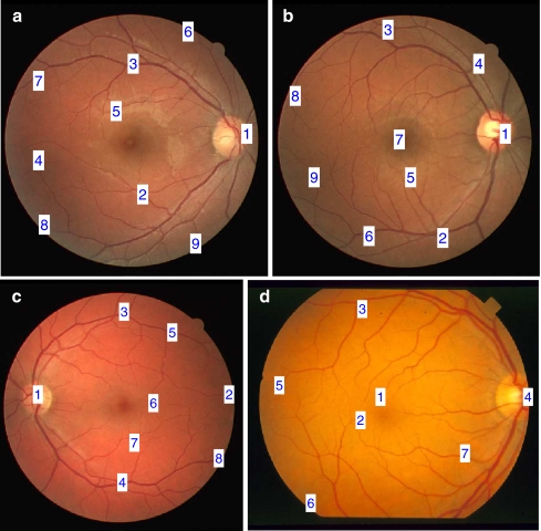 Fig 3.