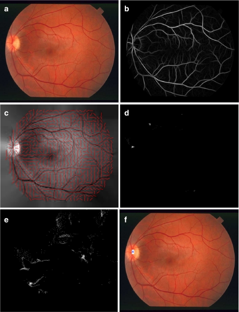 Fig 2.