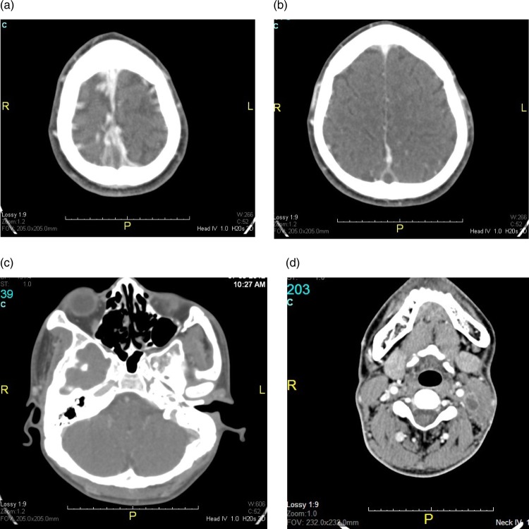 Figure 2