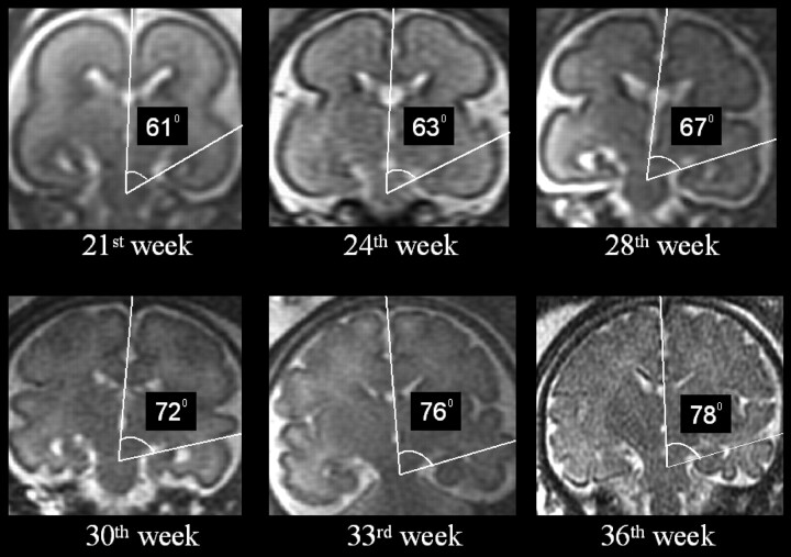 Fig 3.