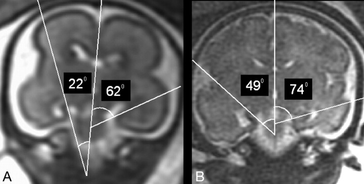 Fig 6.