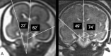 Fig 6.