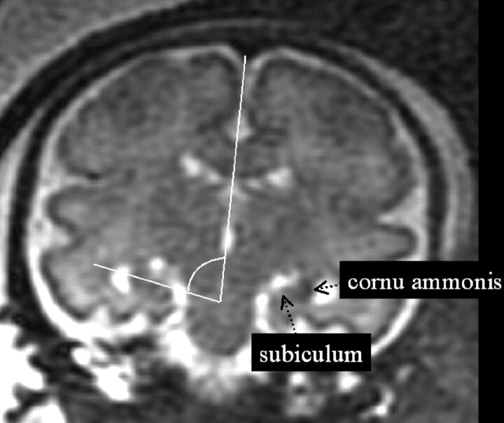 Fig 1.