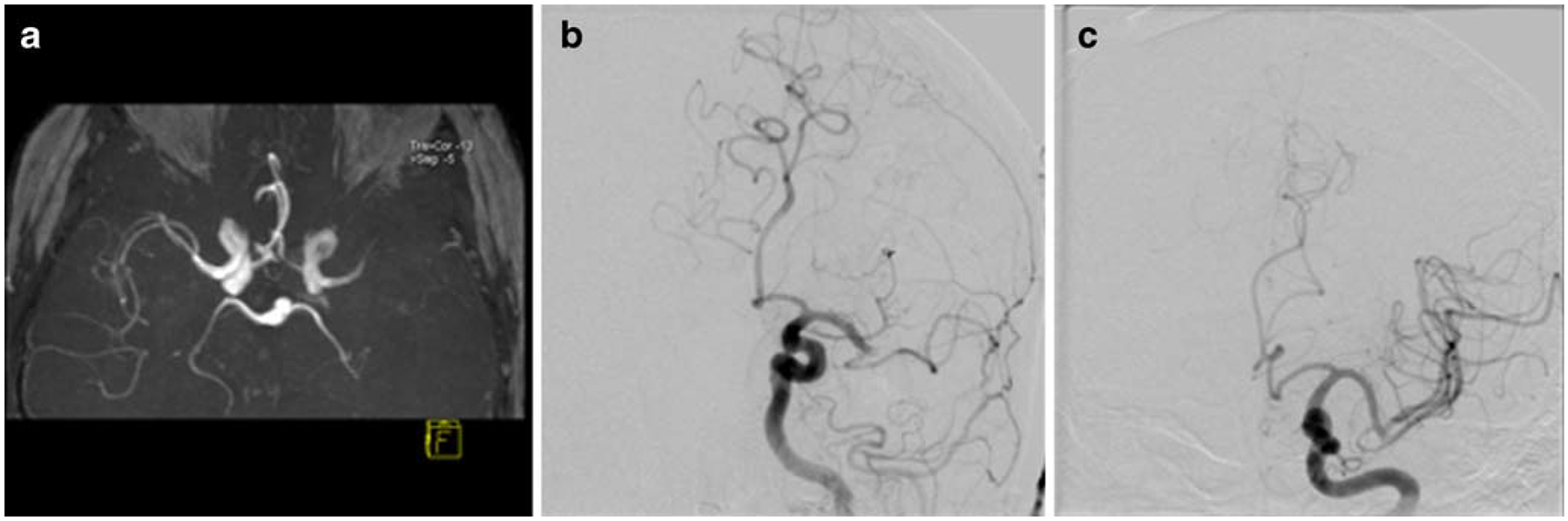 Fig. 5