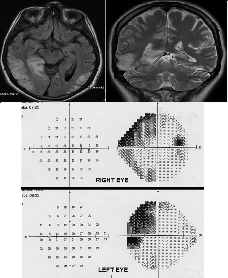 Figure 4