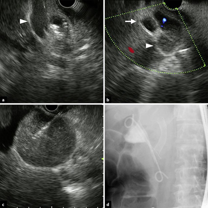 Fig. 2