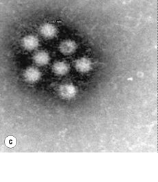 Fig. 35.2