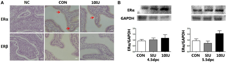 Figure 4