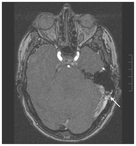 Figure 1: